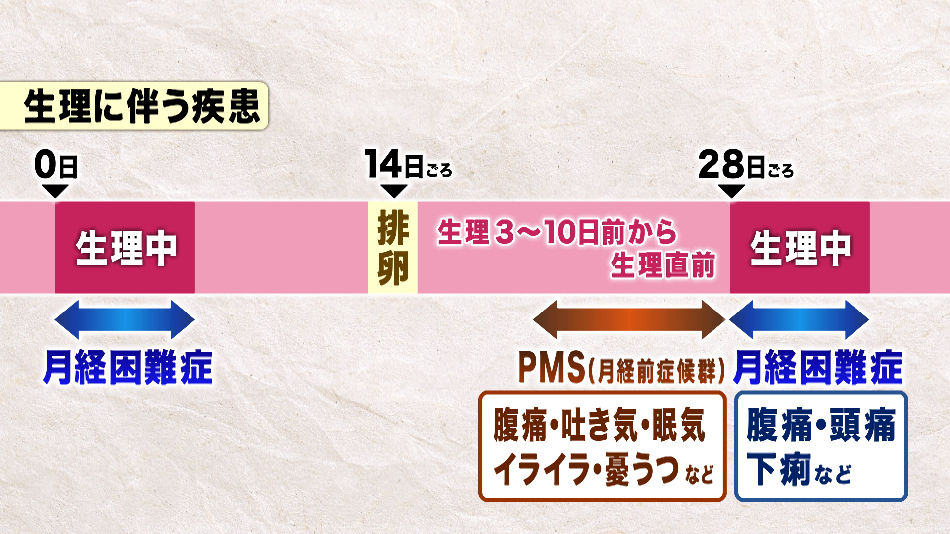 特集 ひどい生理痛 実は 1000万人の女性 が 治療必要 我慢する その先に潜む 危険 特集 報道ランナー ニュース 関西テレビ放送 カンテレ