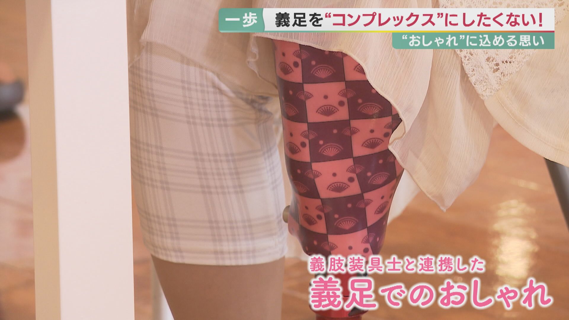 オシャレな義足でコンプレックスをなくせ 隠したいと思っていた 悩む当事者に光 義足見えるドレスで結婚式も 特集 報道ランナー ニュース 関西テレビ放送 カンテレ