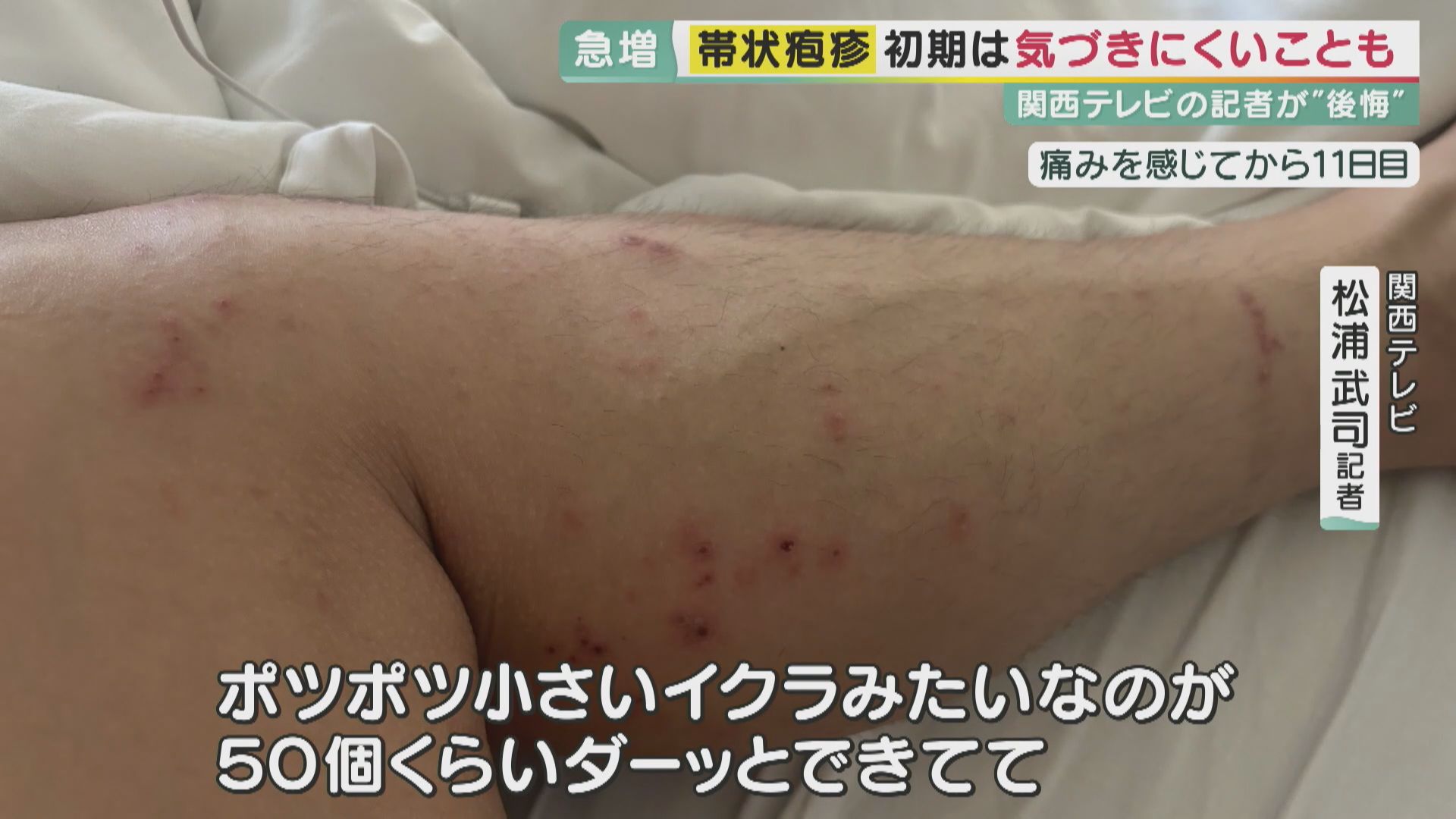 リンドウ・スカブラ