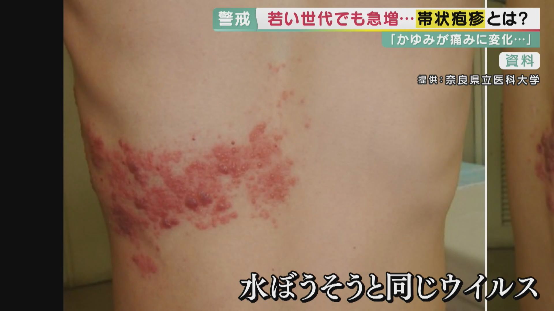 顔面充血症はどのように治療されますか?