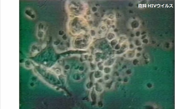 HIV感染の受刑者　治療中断で「エイズ」発症　弁護士会が「適切な情報の引き継ぎ」警察に求める