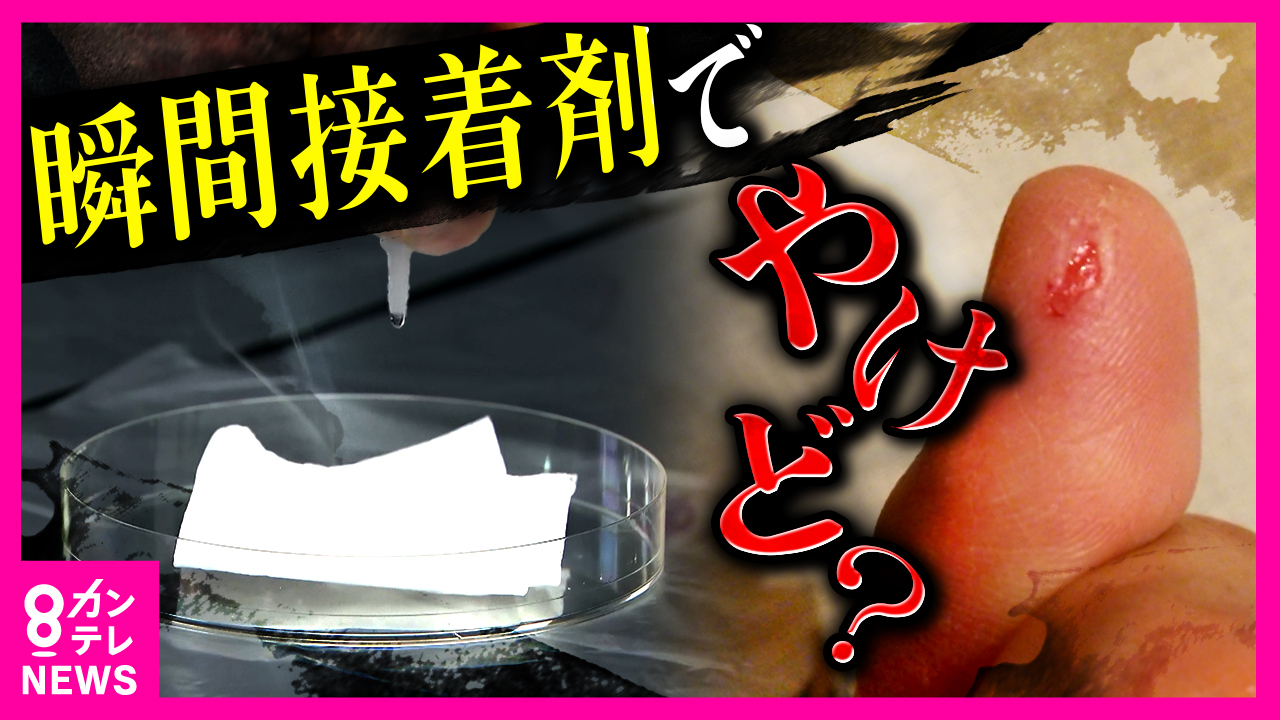 瞬間 接着 剤 指 につい た