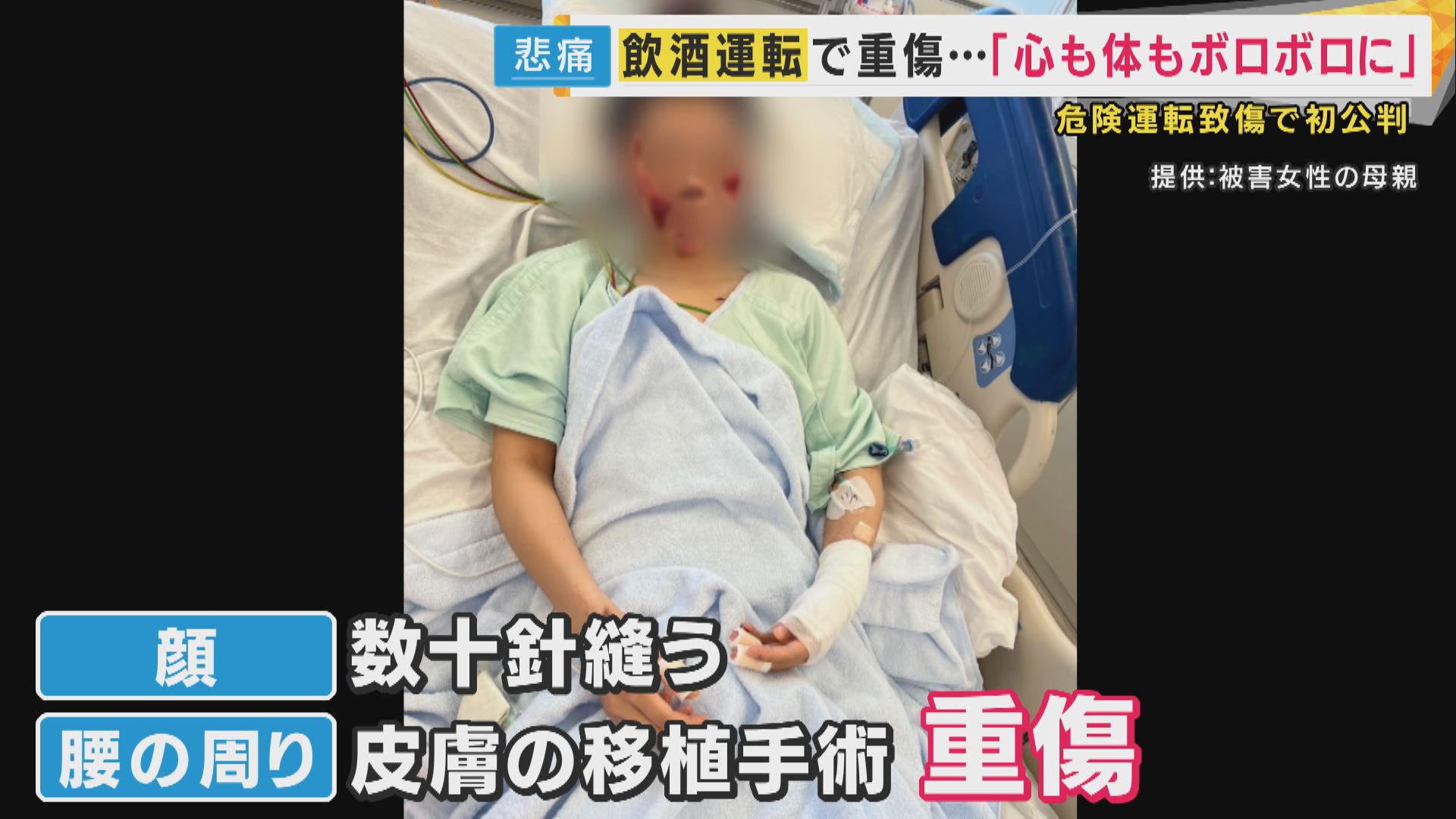 被害女性「傷痕ずっと残る。同じ痛み味わって」飲酒運転で危険運転致傷罪に問われた女　裁判で認否「留保」